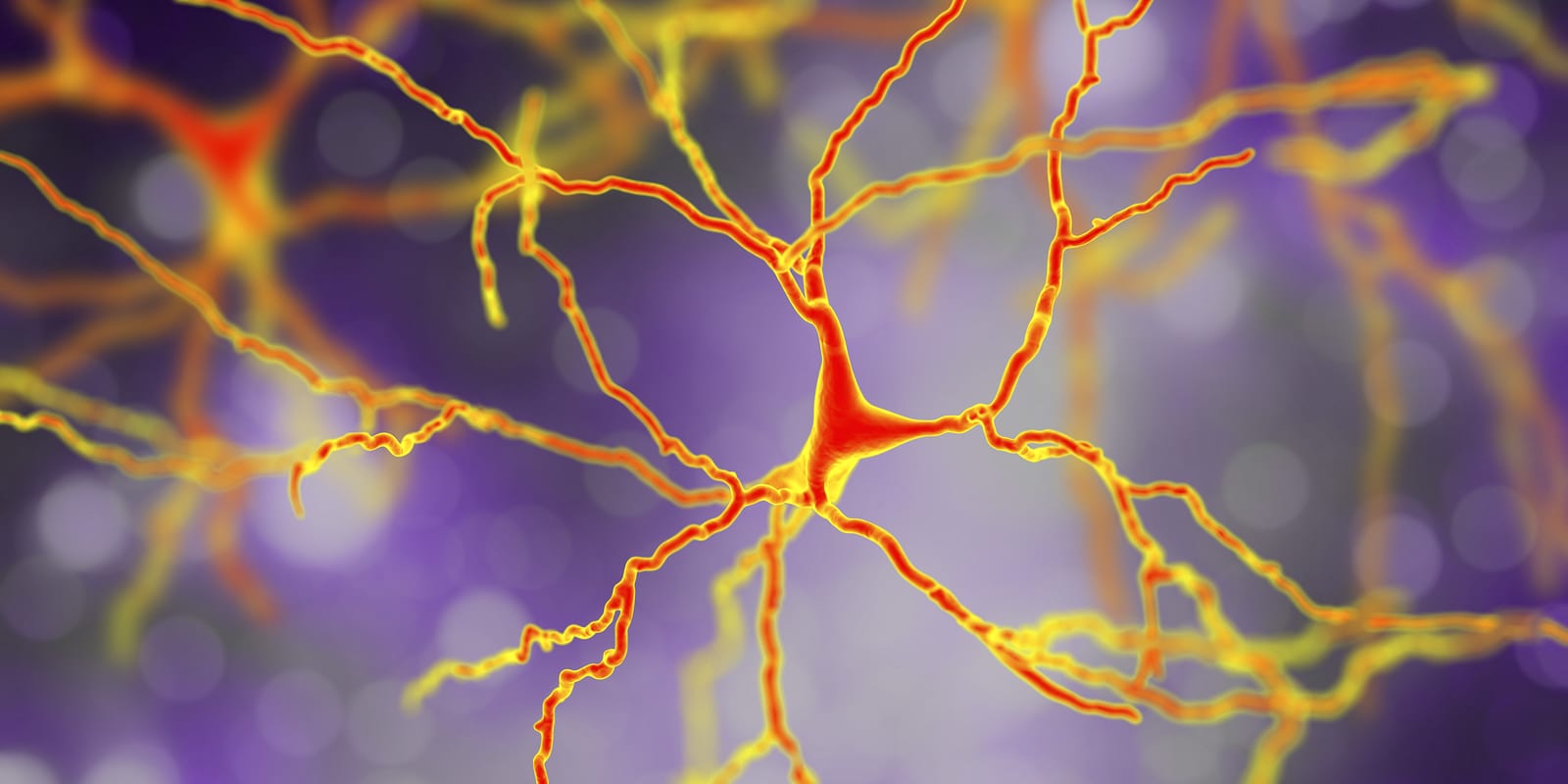 Dopaminergic Neuron, Computer Reconstruction Dopaminergic neuron, computer reconstruction. Dysfunction of this brain cells are responsible for development of Parkinson's disease, autism and schizophrenia, 3D illustration