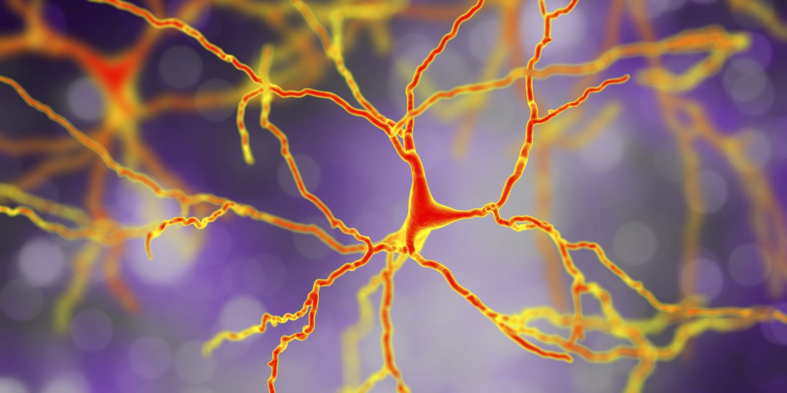 Dopaminergic neuron, computer reconstruction. Dysfunction of this brain cells are responsible for development of Parkinson's disease, autism and schizophrenia, 3D illustration